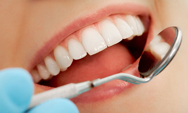 Cách nào khắc phục lại miếng trám răng bị hỏng không?